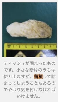 犬が誤飲したティッシュ